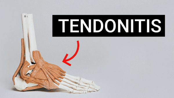 Red Light Therapy For Tendonitis – Mychondria